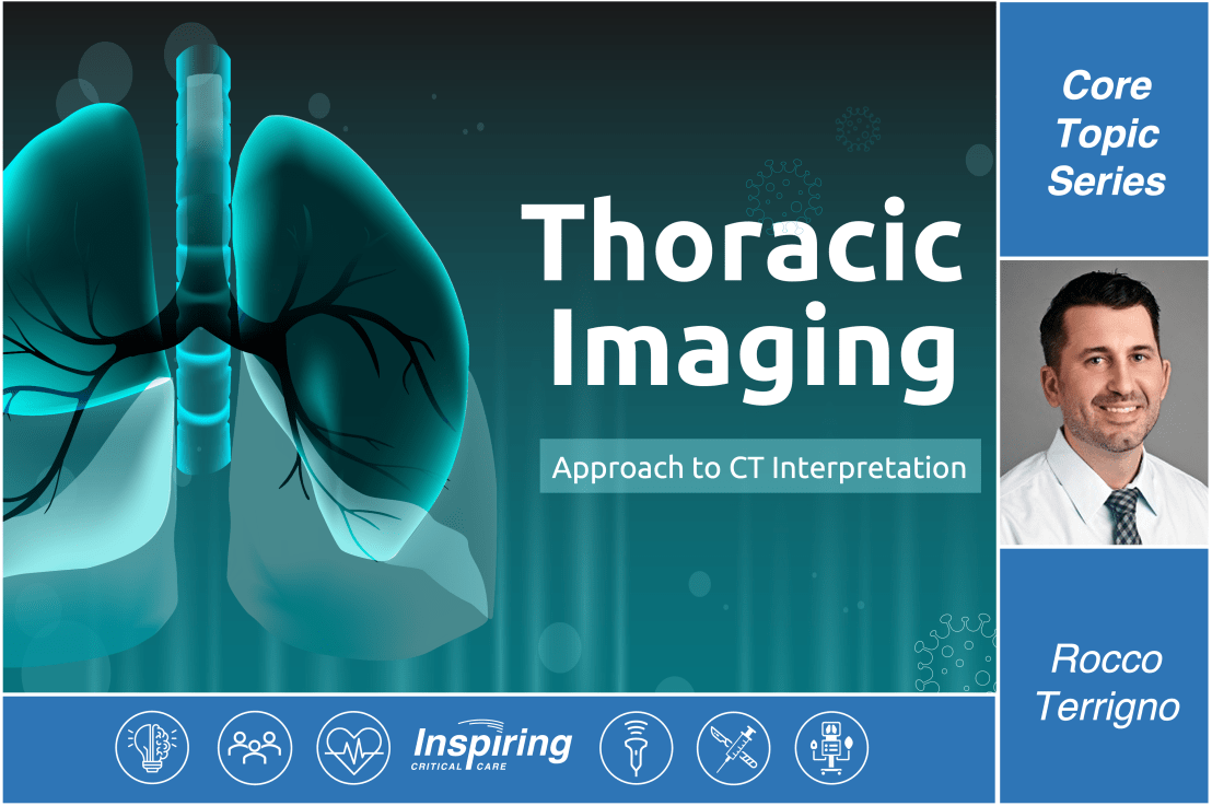 Thoracic CT Imaging –&nbsp;Terrigno