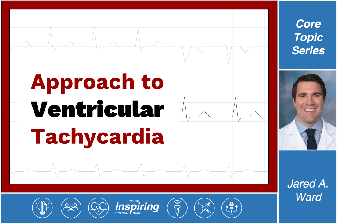 Approach to Ventricular Tachycardia –&nbsp;Ward